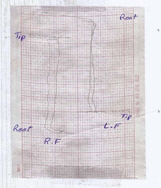 نمونه گراف دنده